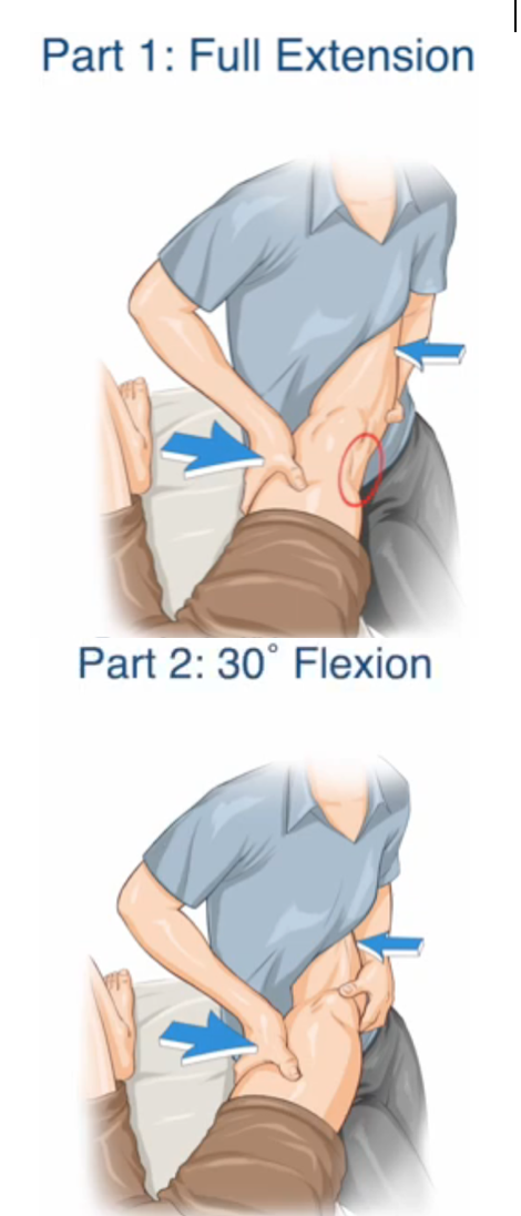 <ol><li><p>Kläm fast patientens underben mellan din arm och midja</p></li><li><p>Stötta upp underbenet med din ena hand genom att hålla under vaden, ganska nära knäet</p></li><li><p>Placera din andra hand på knäets insida</p></li><li><p>Håll benet i extenderat läge</p></li><li><p>Applicera ett valgustryck med “knä-handen” och tryck underbenet utåt med kroppen och andra handen</p></li><li><p> . Notera smärta och rörelseomfång.</p></li><li><p>Upprepa testet med knäet lätt flekterat</p></li></ol>