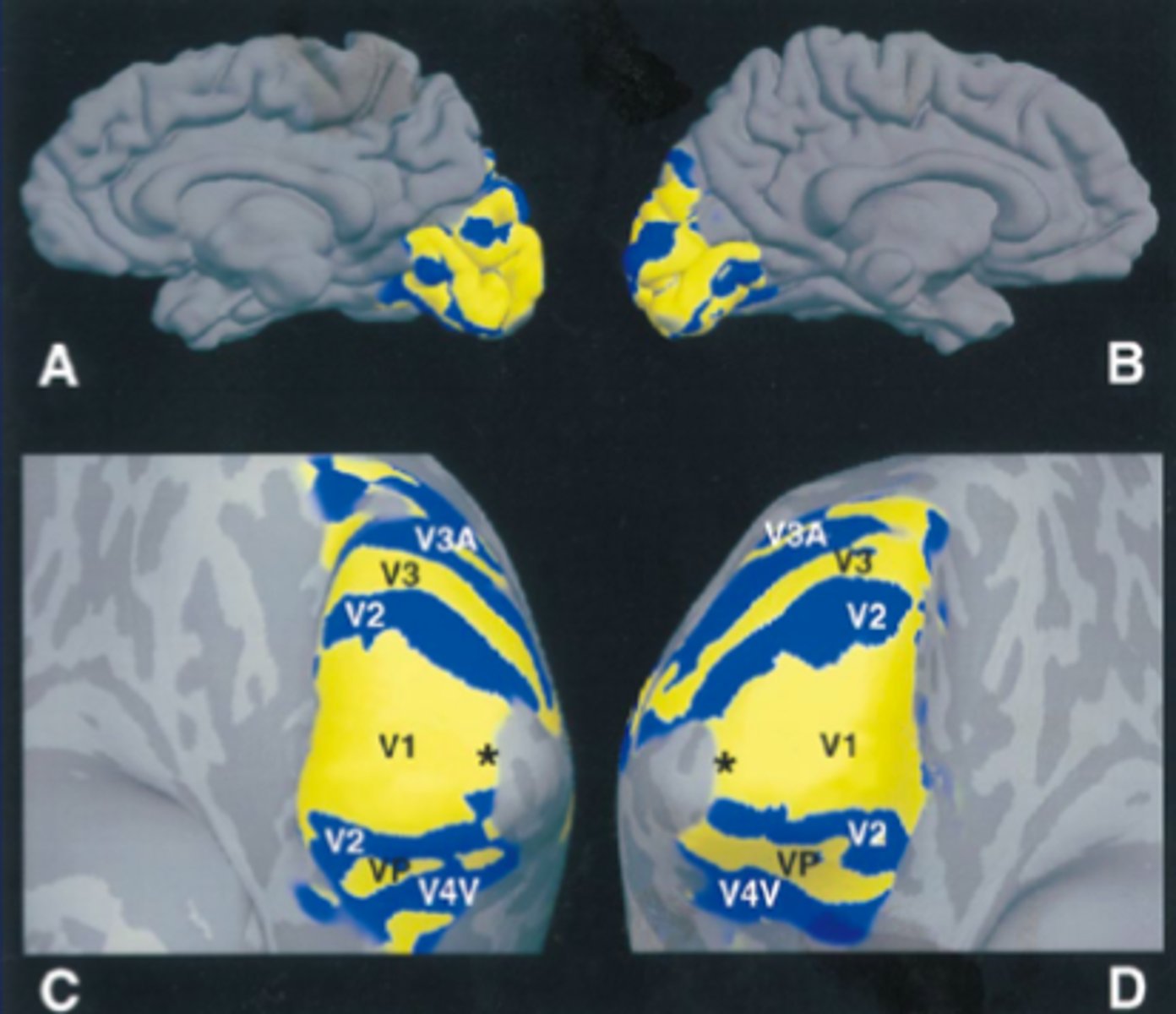 <p>1. Highlights active areas of the brain.</p><p>2. Detects changes in the blood oxygenation and flow that occur due to neural activity in the brain.</p><p>3. When a brain area is more active , it consumes more oxygen and blood flow is directed to that active area.</p>