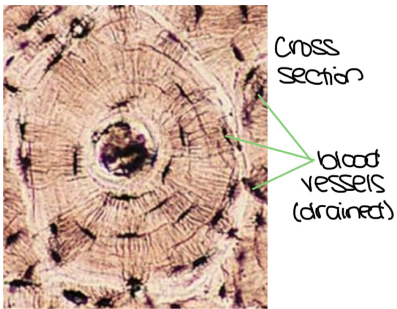 <p><span style="color: #83cd47"><strong>Bones </strong></span></p>