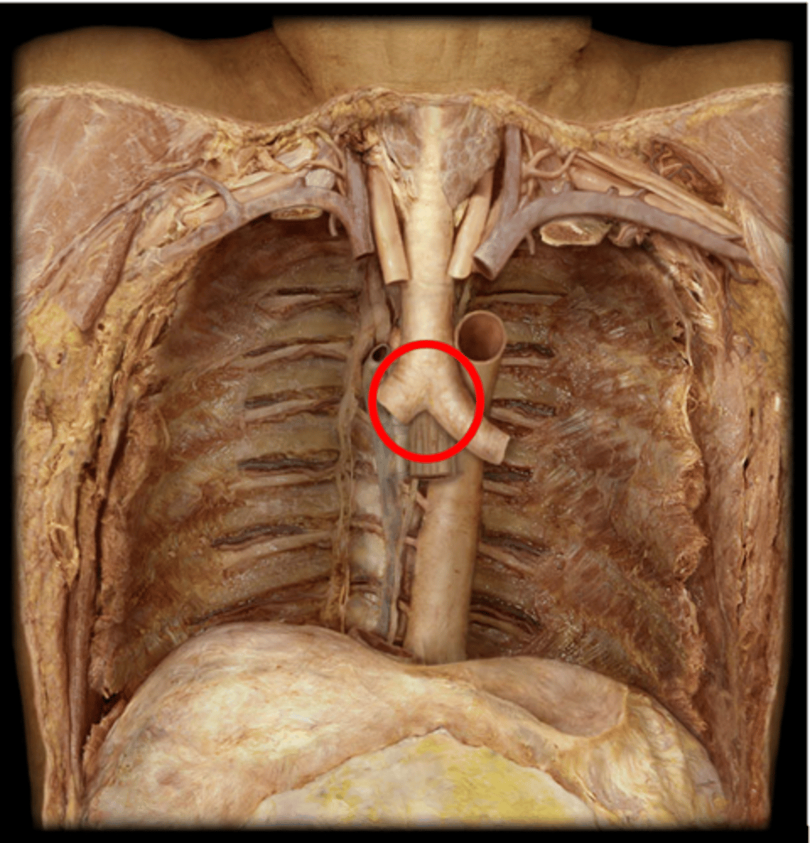 <p>the division middle of the tracheal split</p><ul><li><p>division</p></li></ul><p></p>