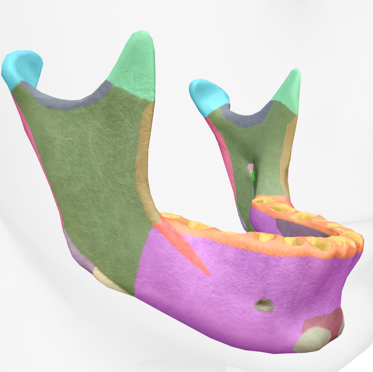 <p>top of the condylar process of the ramus of the mandible </p>