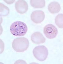 <p>Dr. Vicente Y. Belizario Jr.</p>