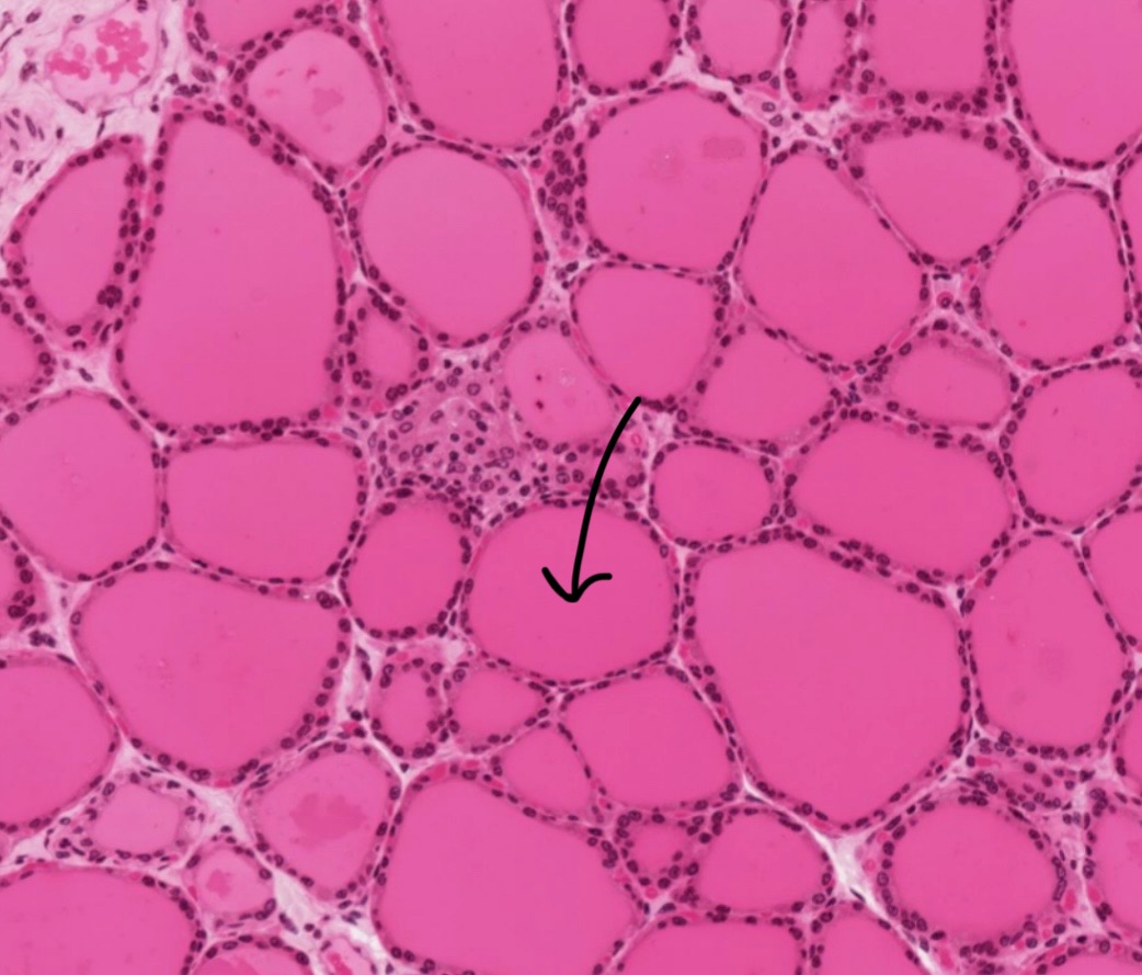 term image