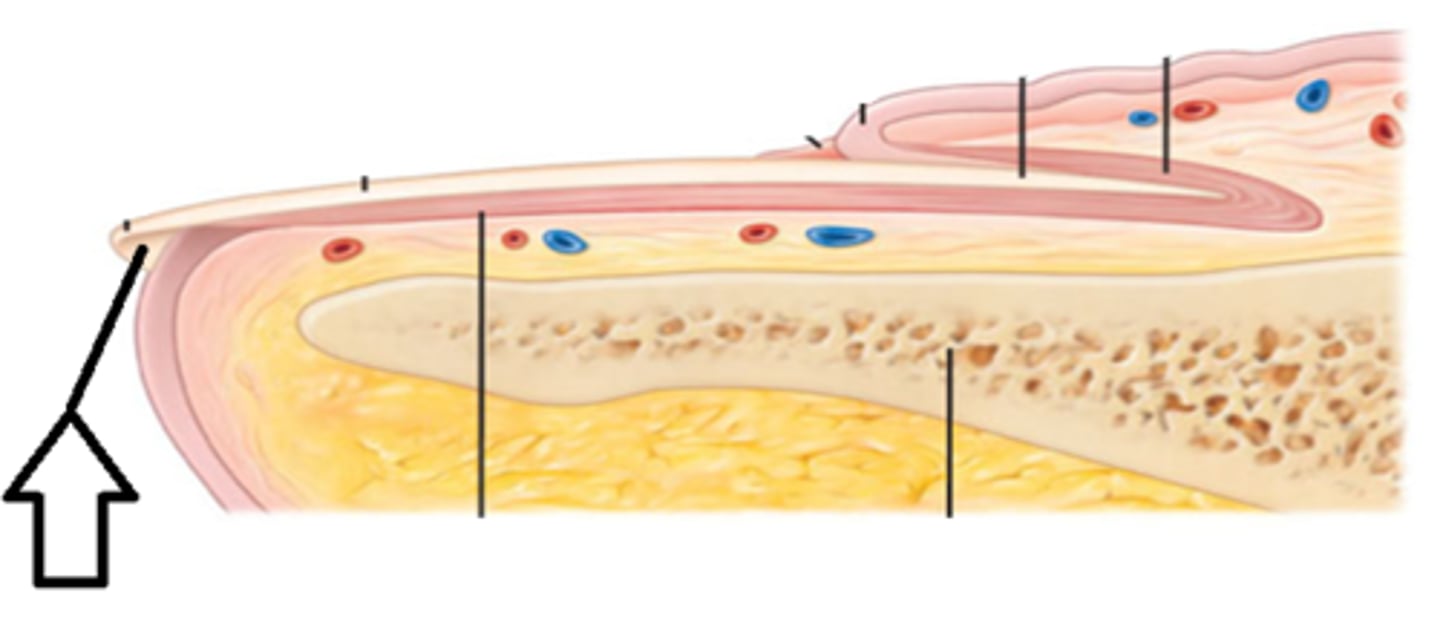 <p>thickened stratum corneum under where free nail edge hangs</p>