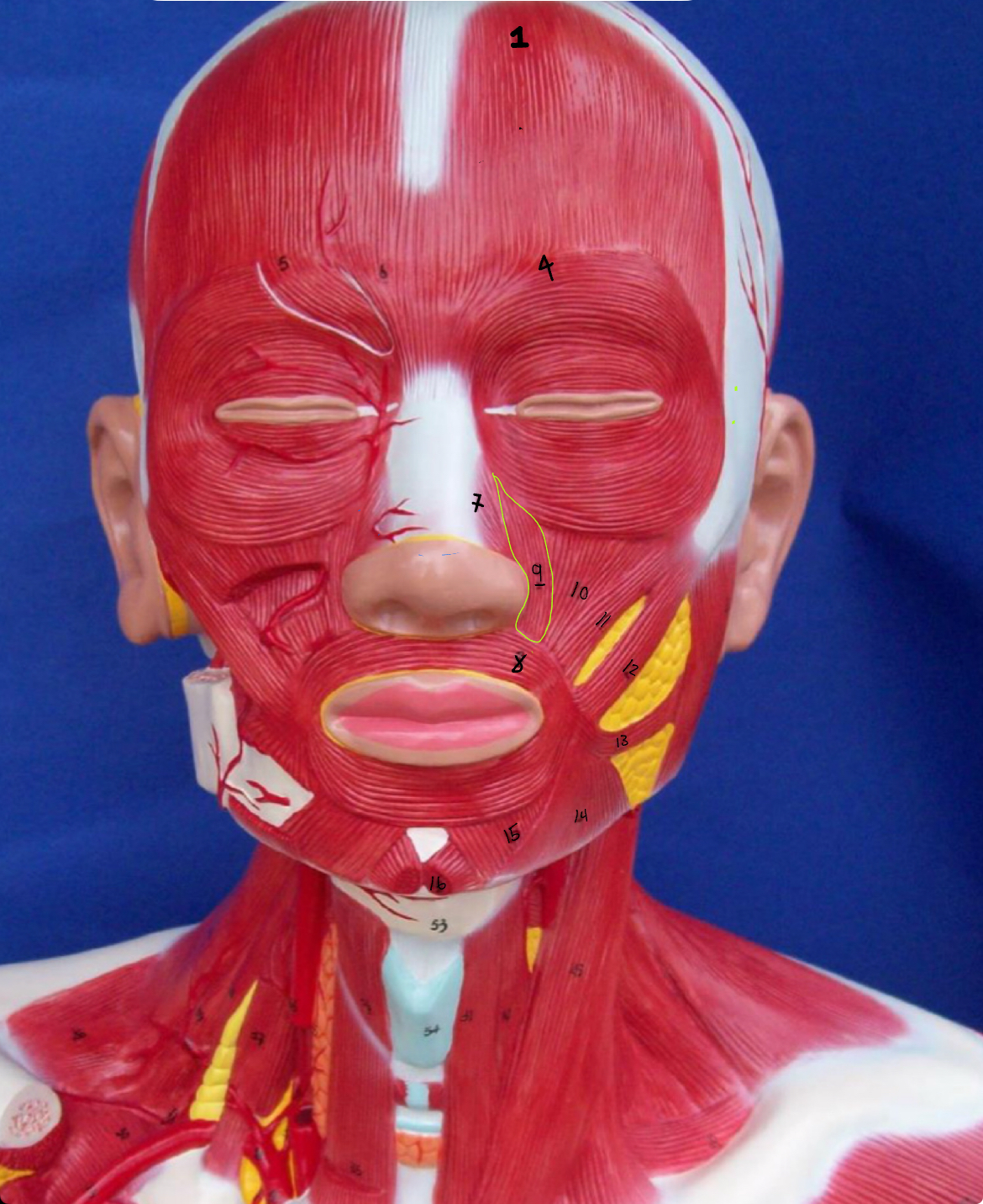 <p>what type of muscle is this (altay)</p>