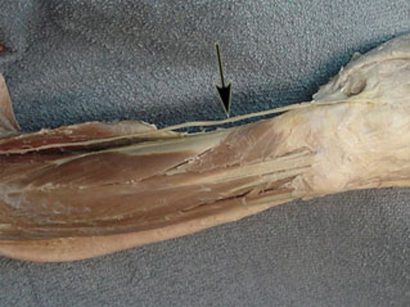 <p>ID nerve</p>