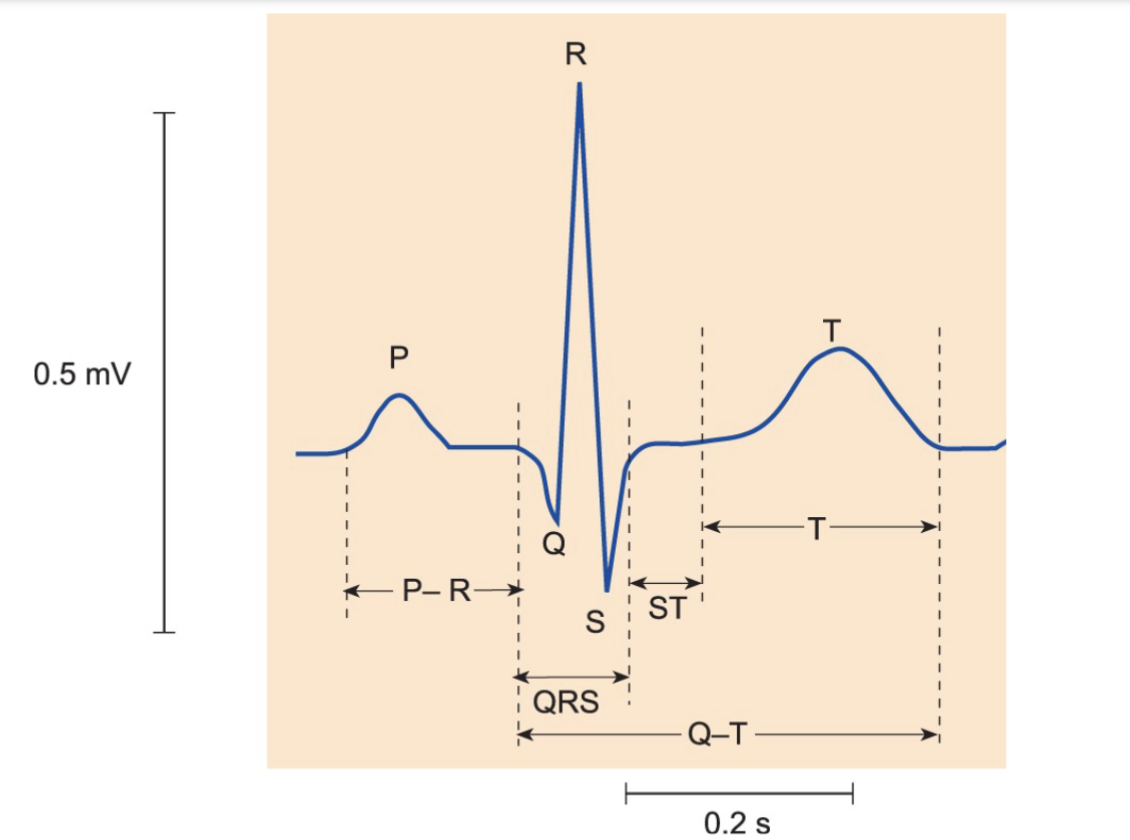 Consistent time intervals between each P wave & its corresponding QRS complex.
