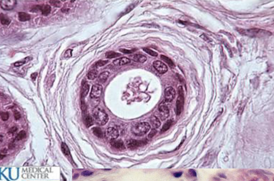 <p>What type of tissue is present in this image?</p>