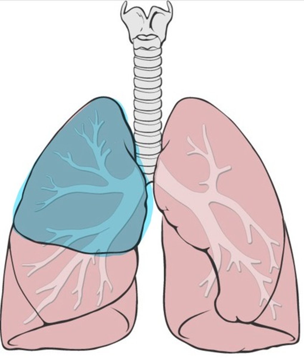 <p>Top lobe of the right lung</p>