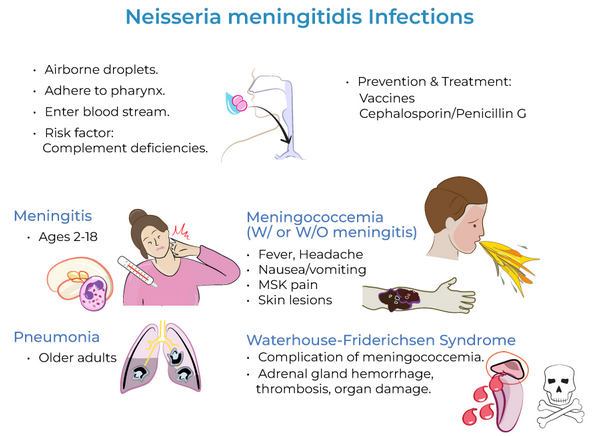 <p><strong>Progresses rapidly </strong>with symptoms like headache, fever, and vomiting (especially in young children).</p>