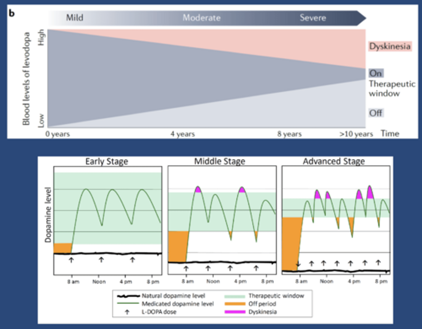 <p>-In regards to L-DOPA treatment</p><p>-On: when pt has control of their symptoms</p><p>-Off: when pt doesn't have control</p><p>-First 1-2 years pt has smooth, day long control of symptoms</p><p>-At 2-5 years: peak dose dyskinesia, symptoms return at low plasma conc but before it's time for the next dose</p><p>-Reason: therapeutic plasma conc narrows as more and more neurons die</p>