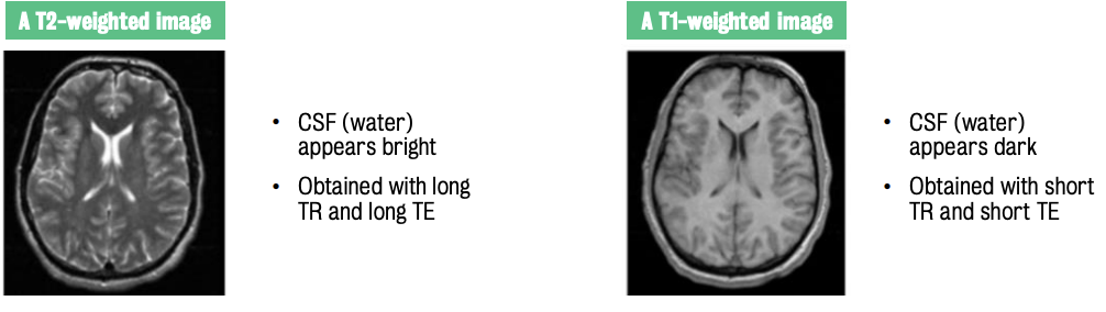 Consequences of different T2 value manipulation