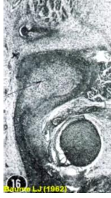 <p>-only found in condylar process</p>