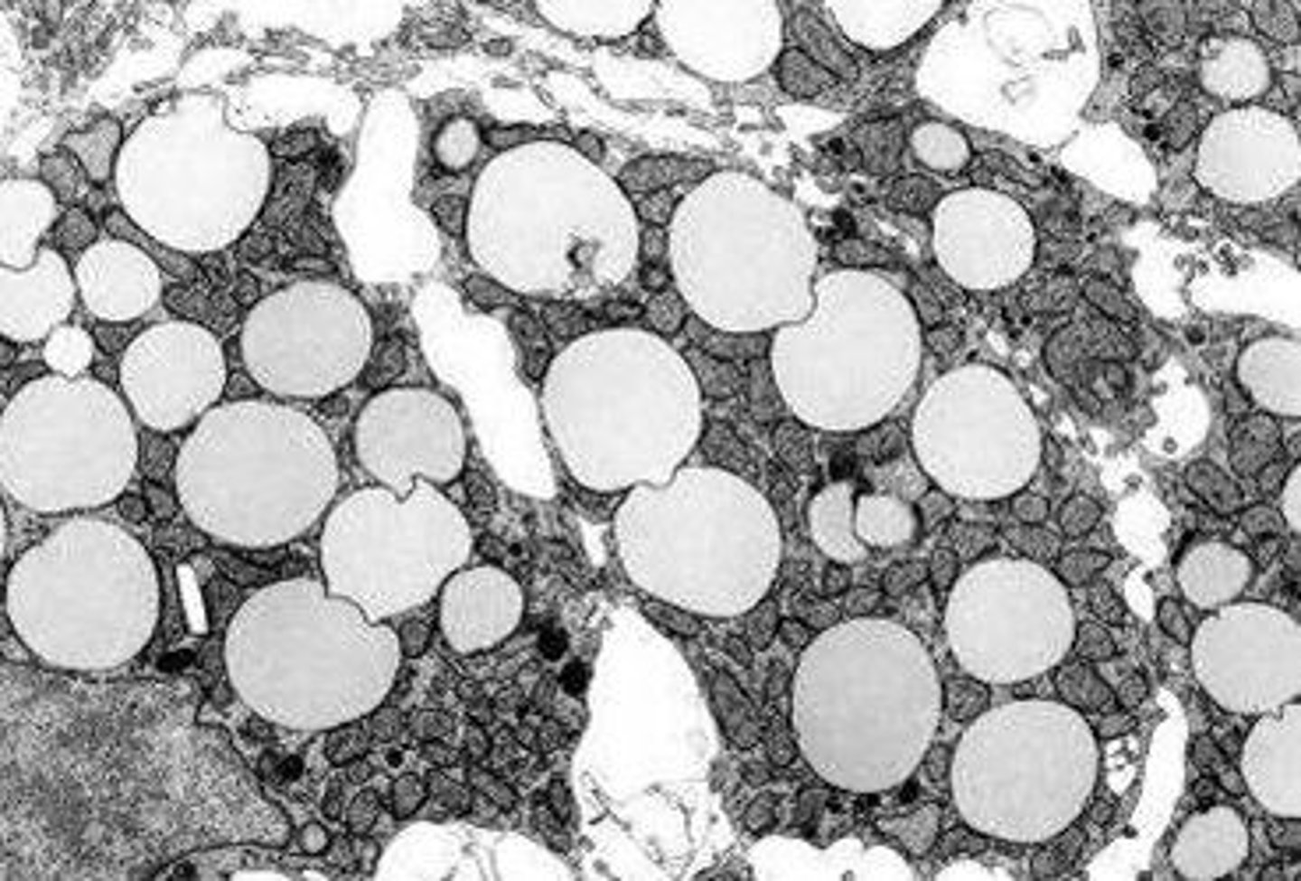 <p>The roughly spherical inclusions in the electron micrograph shown below are not membrane-bound, and are common in adipocytes and steroidogenic cells. What are they?</p><p>a. Lipid droplets</p><p>b. Endosomes</p><p>c. Secretory vesicles</p><p>d. Lysosomes</p><p>e. Peroxisomes</p>