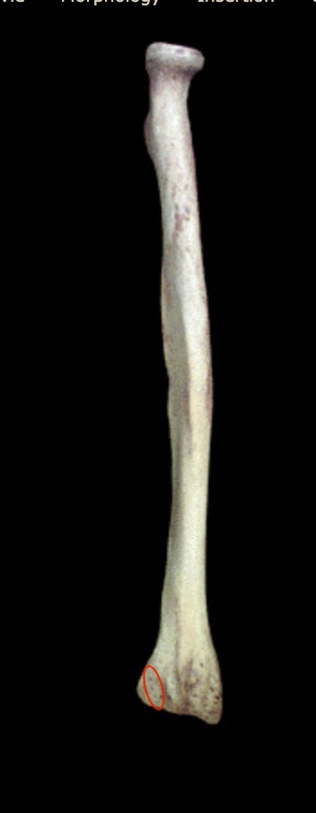 <p>What structure is this?</p>