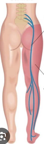 <p>what nerve and from which plexus?</p>