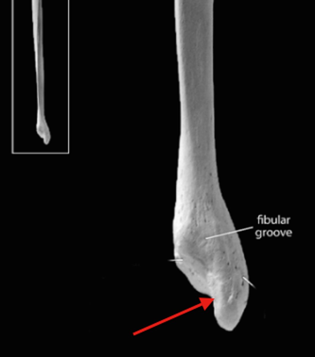 <p>posterior</p>