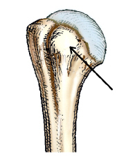 The small, rounded, elevated process identified by the arrow in this figure is the: