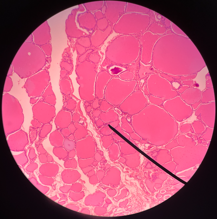 • One of the cells composing a thyroid follicle.

• Secretes calcitonin.

• Appears pale when stained.

• Also known as clear or C cells.