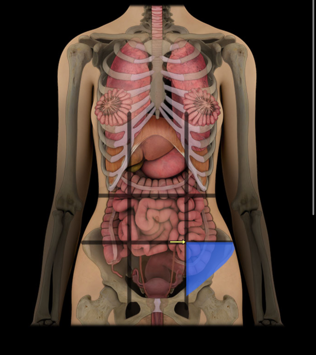 <p><span style="color: red;"><strong>Lower left near groin; </strong></span><strong>contains intestines.</strong></p>
