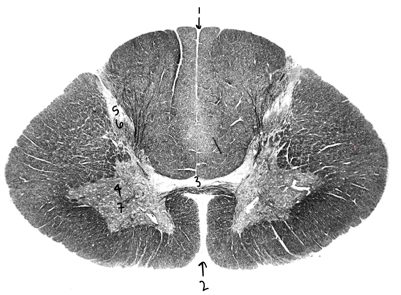 <p>What structure is labeled 2?</p>