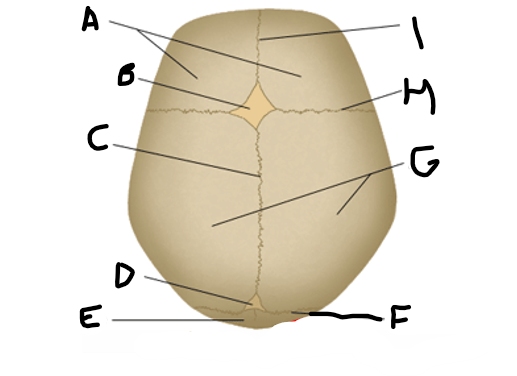 <p>sagittal suture</p>