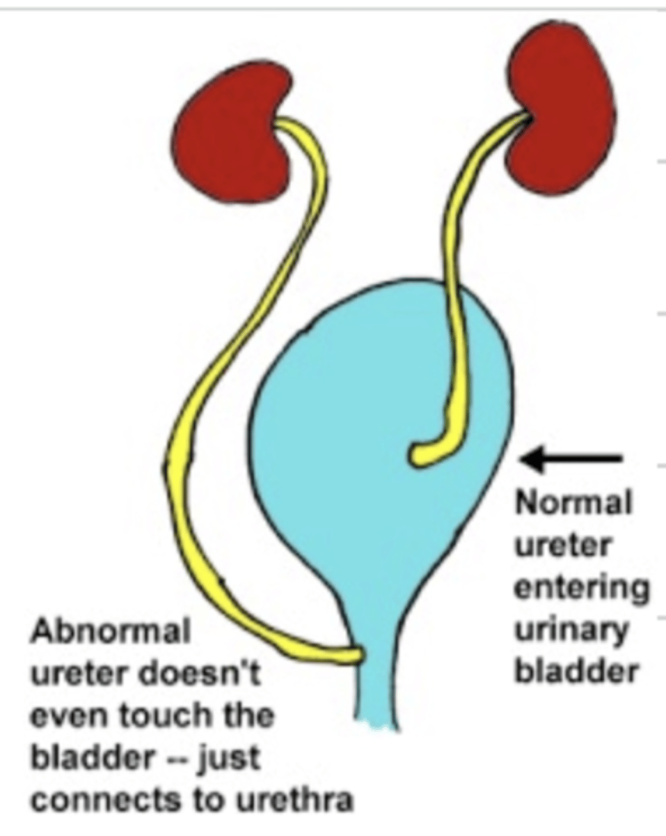 <p>-urinary incontinence</p><p>-perineal dermatitis</p>