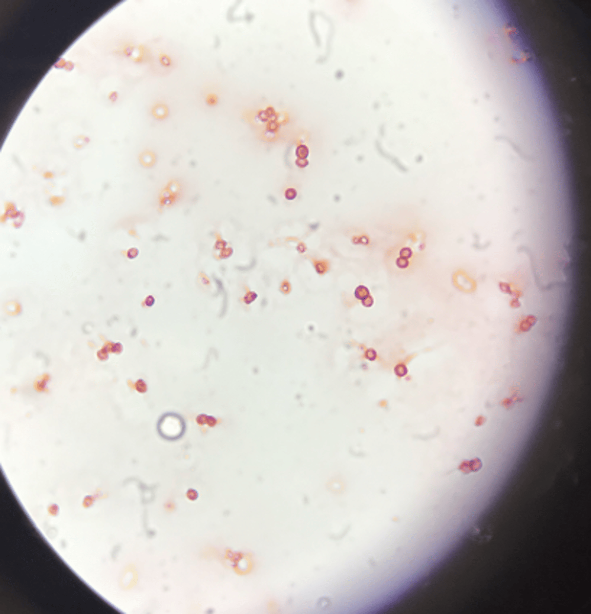 <p>- Gram-negative to Gram-variable</p><p>- nitrogen fixers!</p><p>- much larger than most bacteria</p><p>- commonly contain poly-(beta)-hydroxybutyrate (PHB)</p><p>- obligately aerobic chemoheterotrophs</p><p>- makes a slime layer to help create anaerobic respiration happen (makes a barrier to oxygen)</p>
