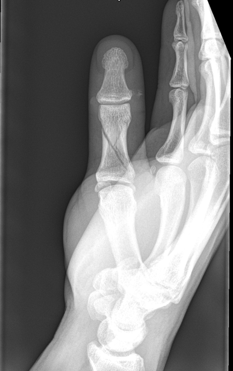 <p>What view is this radiograph? What side?</p>