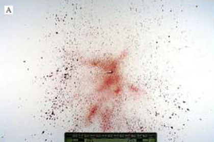 <p>What bloodstain pattern is this?</p>