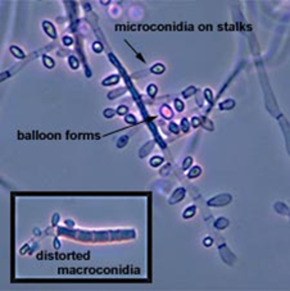 <p>Colony: powdery-downy, white-yellow-beige</p><p>Reverse: brown or red-brown</p><p>Microconidia: teardrop, club, balloon shaped, numerous</p><p>Macroconidia: club-shaped/curved, may be absent; septate</p><p>septate hyphae</p><p>Disease: tinea capitis (#1 cause in US)</p><p>--Skin, nails also possible</p><p>--anthropophilic</p>