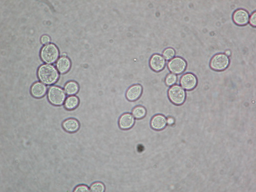 <p>What Phylum does the picture belong to? What is it?</p>