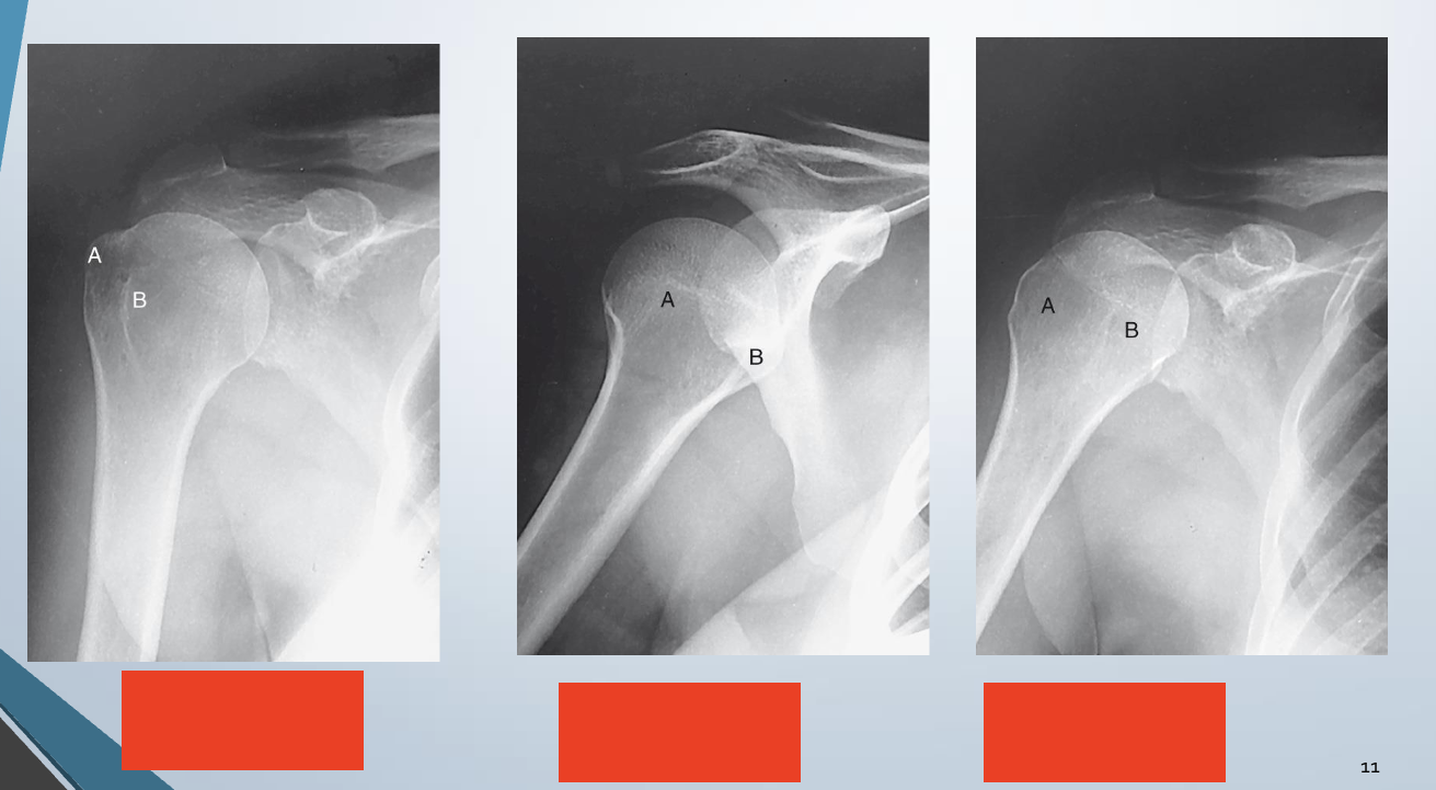 <p>Label - </p><p>Neutral, External, Internal</p>