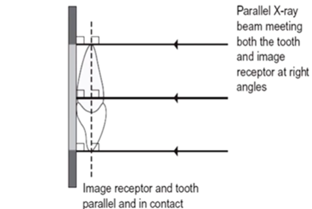 <ul><li><p>and as <strong>parallel </strong>to the detector as possible </p></li><li><p>this is quite difficult due to the patient’s <strong>anatomy #</strong></p></li><li><p>we have developed <strong>techniques </strong>to <strong>try </strong>and make the person’s anatomy as parallel as possible to minimize distortion </p></li></ul><p></p>