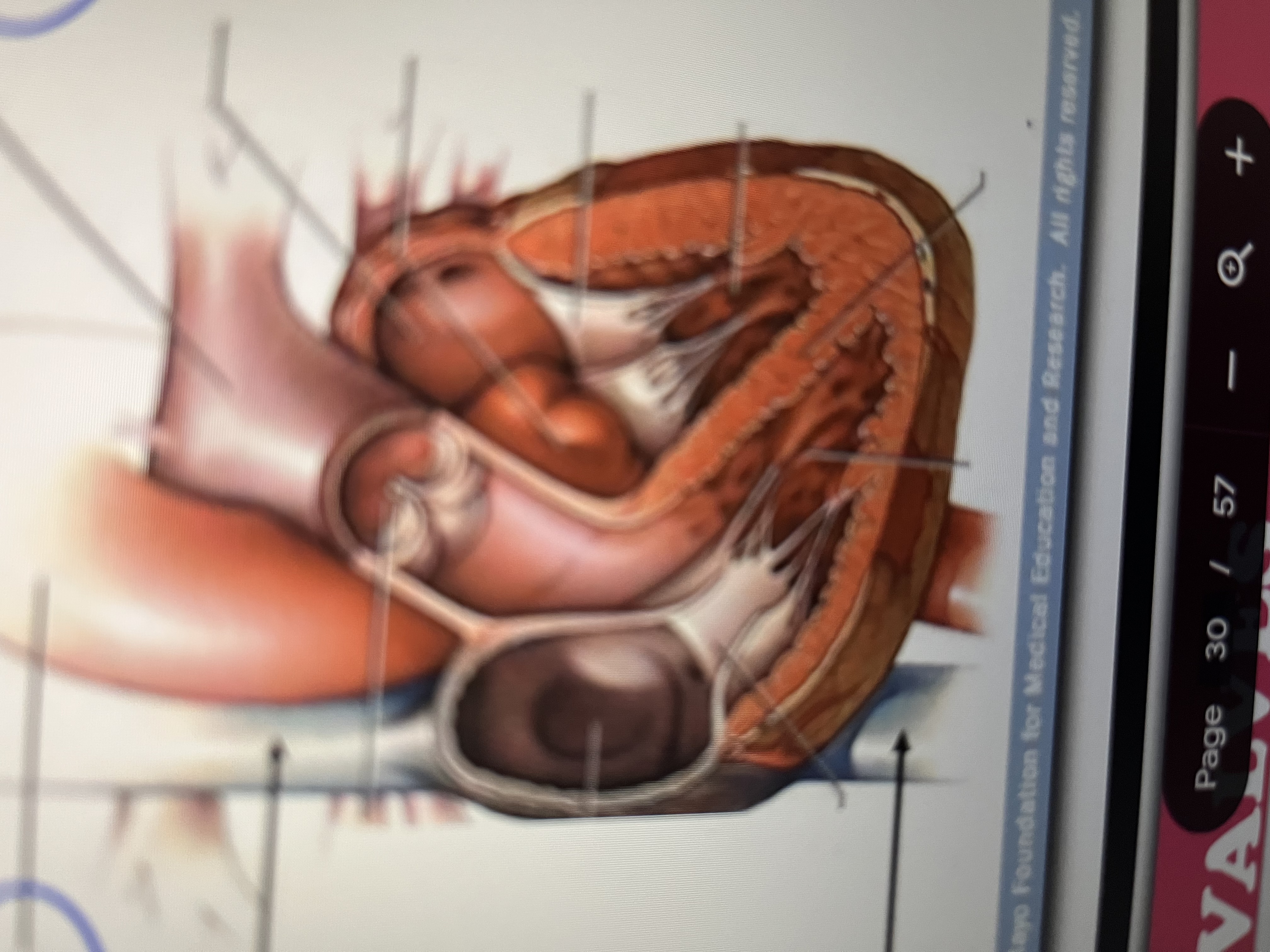 <p>Aorta, Pulmonary artery, Inferior vena cava, superior vena cava</p>