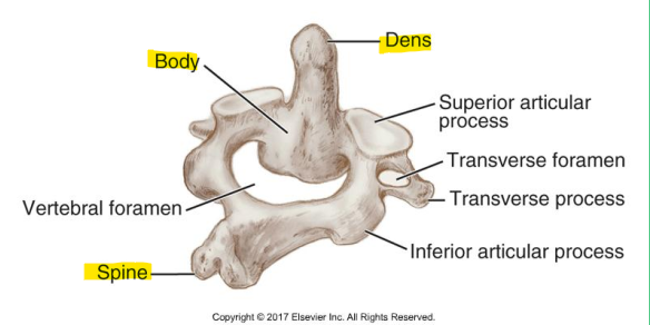 <ul><li><p>Dens = odontoid process</p></li><li><p>Body = inferior to the dens</p></li><li><p>Spine = posterior to the body </p></li></ul><p></p>