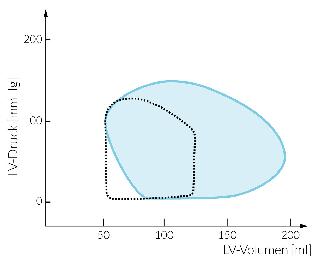 <p>C. Increased aortic pulse pressure (widened blood pressure amplitude)</p>