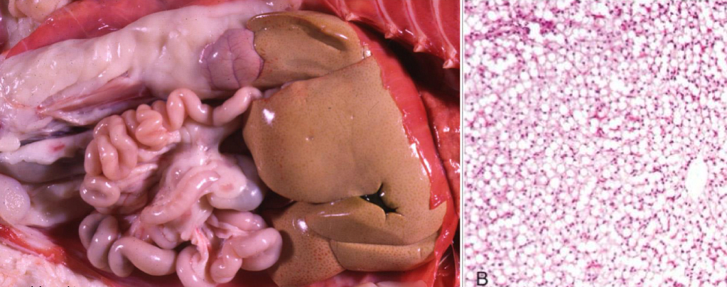 <p>what is being shown in this liver **</p>