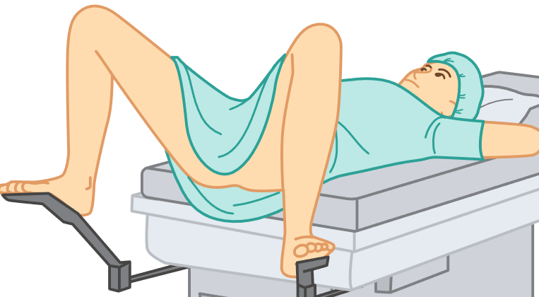 <p>patient lies flat on their back with knees bent and feet in stirrups attached to the table.</p><ul><li><p>vaginal examinations.</p></li></ul><p></p>