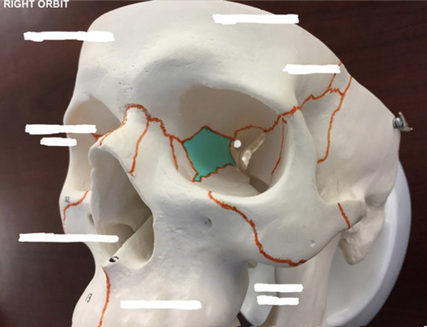 <p>What bone is highlighted here?</p>