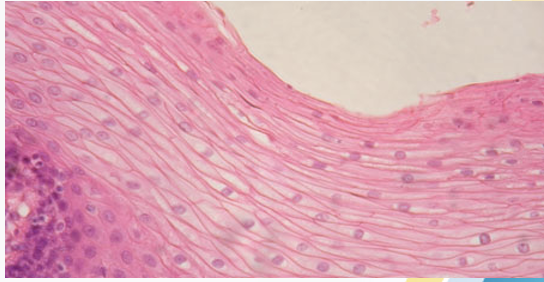 <p>(Lining the esophagus)</p>