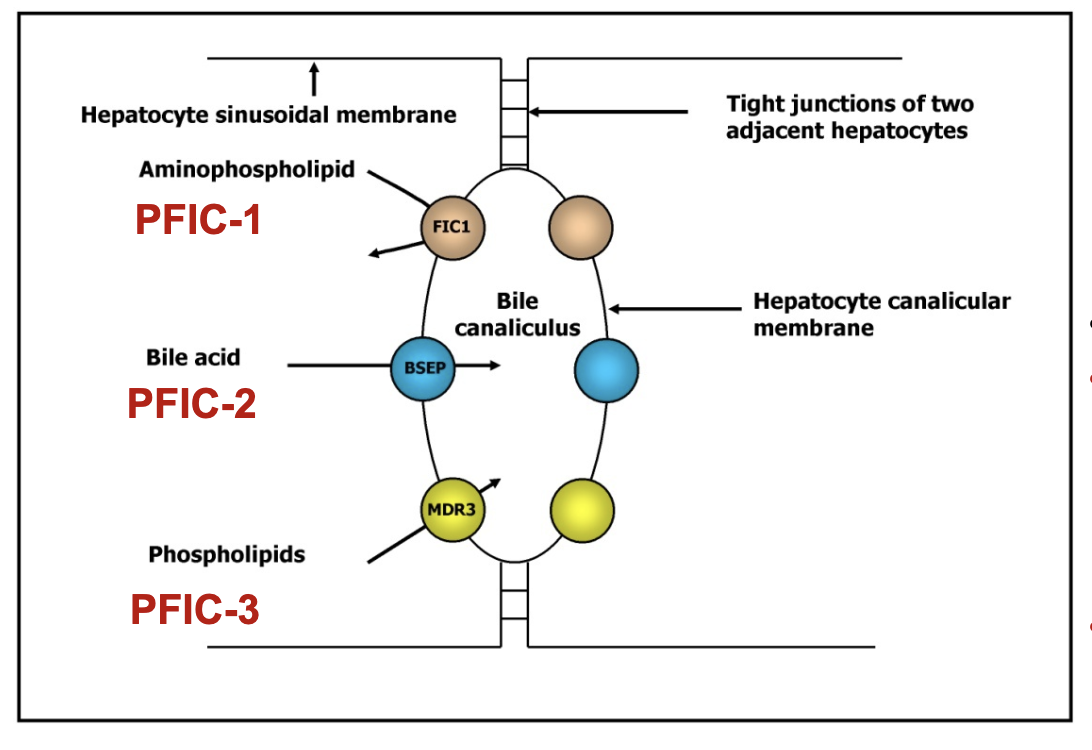 <ul><li><p><span>PFIC‑1 (Byler disease):</span></p><ul><li><p><span>Mutation: ATP8B1 (FIC‑1) for </span><strong><em><u><span>ATPase FIC-1</span></u></em></strong></p></li><li><p><span>Defective phospholipid translocation</span></p></li><li><p><span>Symptoms: </span><strong><span>short stature,</span></strong><span> </span><strong><span>deafness</span></strong><span>, diarrhea, </span><strong><span>pancreatitis</span></strong><span>, low fat‑soluble vitamins, </span><strong><span>early liver failure</span></strong></p></li></ul></li><li><p><span>PFIC‑2:</span></p><ul><li><p><span>Mutation: ABCB11 (BSEP)</span></p></li><li><p><span>Defective bile salt export pump → bile salt retention → </span><strong><span>cholestasis</span></strong></p></li></ul></li><li><p><span>PFIC‑3:</span></p><ul><li><p><span>Mutation: </span><strong><em><u><span>ABCB4 </span></u></em></strong><span>(MDR3) for multidrug resistant protein 3 (MDR3) or floppase</span></p></li><li><p><span>Lack of phosphatidylcholine in bile → free bile acids damage biliary epithelium → </span><strong><span>liver disease</span></strong></p></li></ul></li></ul><p class="p4"><span>All PFIC: cholestasis, jaundice, failure to thrive, intense pruritus.</span></p>