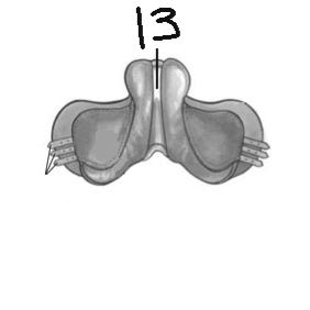 <p>label #13</p>