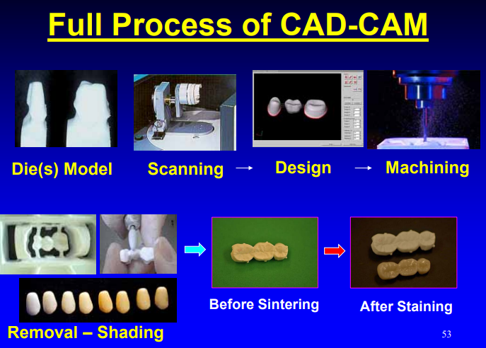 <p>dies/models → scanning → design → machining → removal/shading → sintering/stain </p>