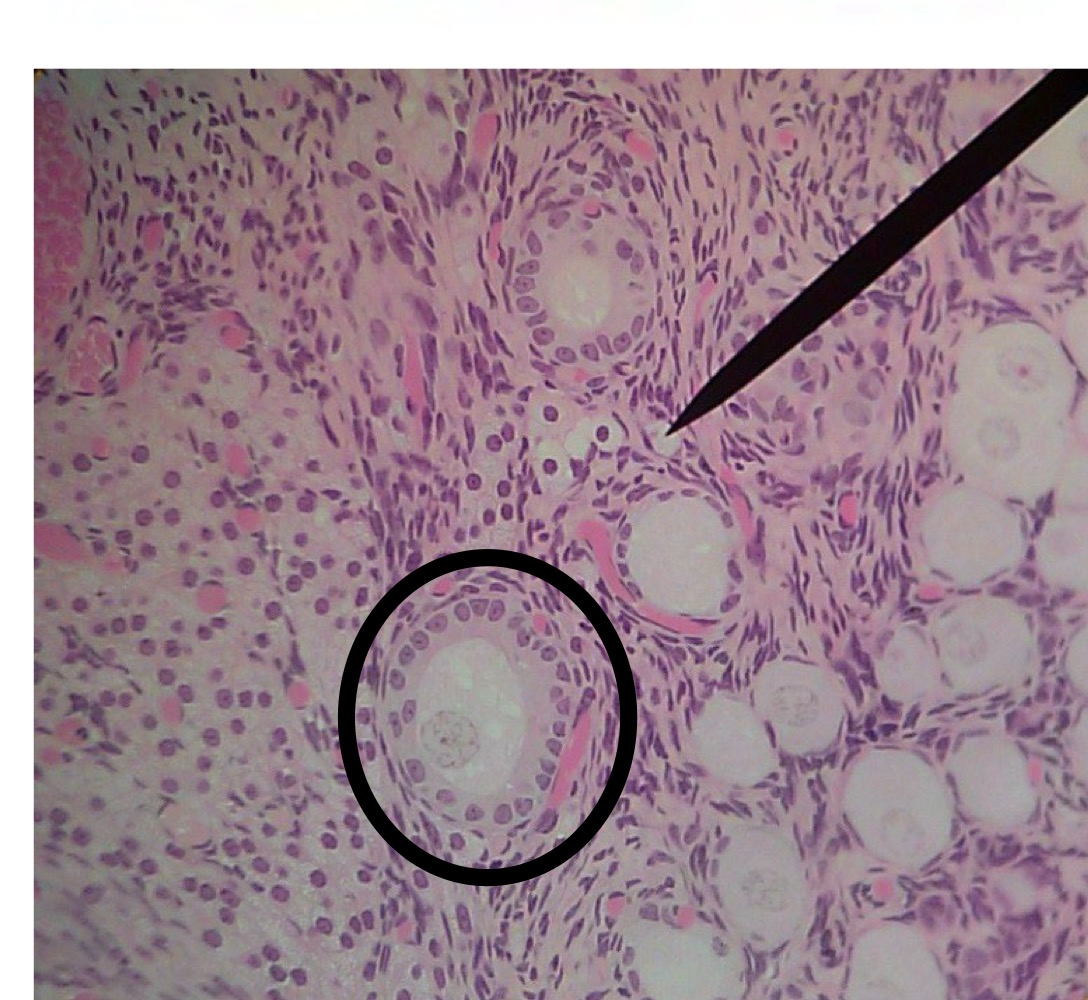 <p>Primary follicle </p>