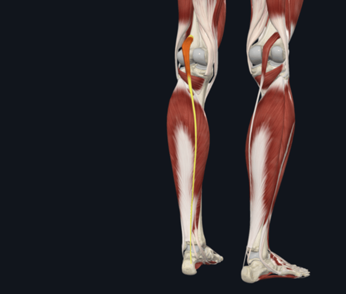 <p>name the yellow highlighted muscle </p>