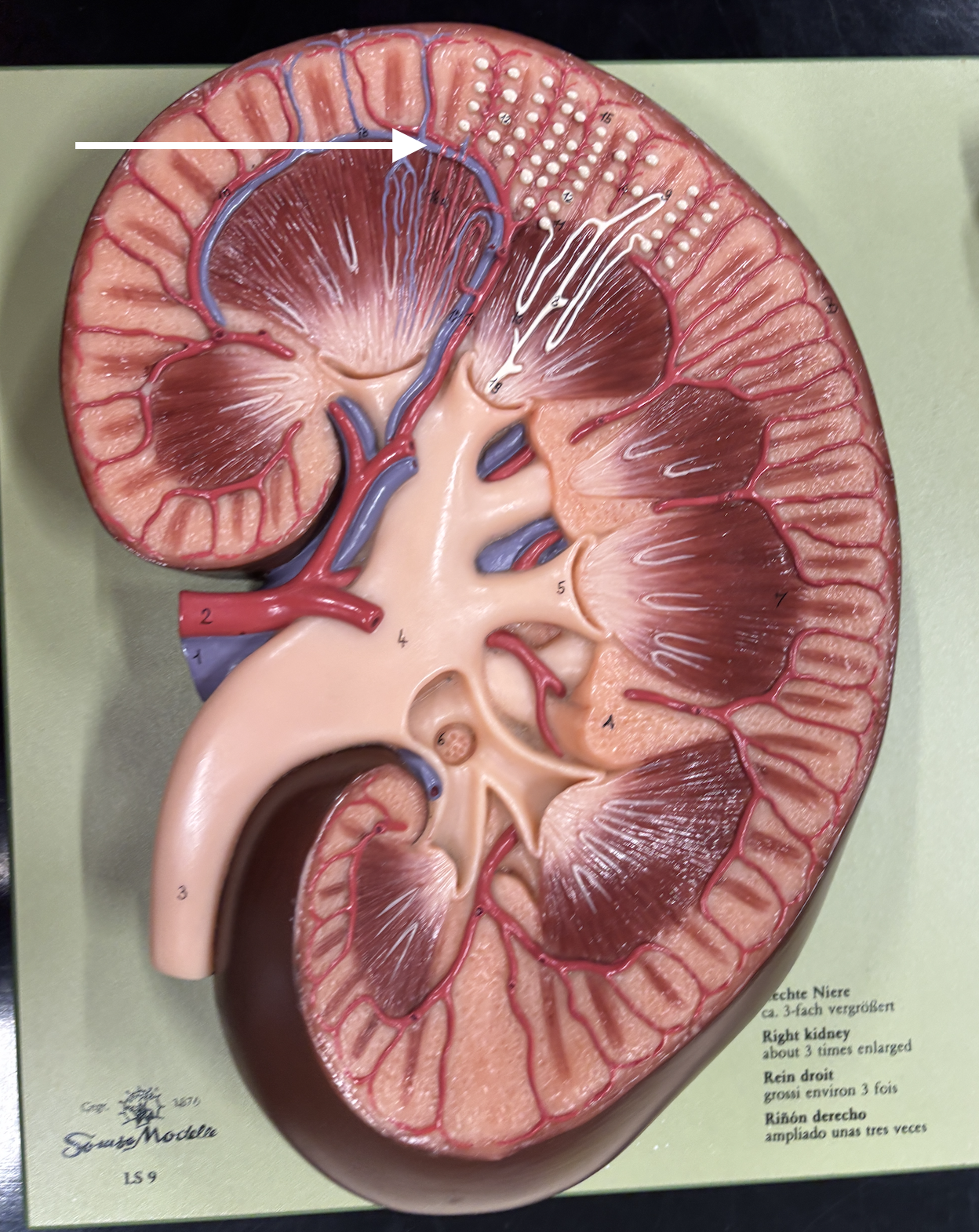 <p>what structure is the arrow pointing to? *vein*</p>