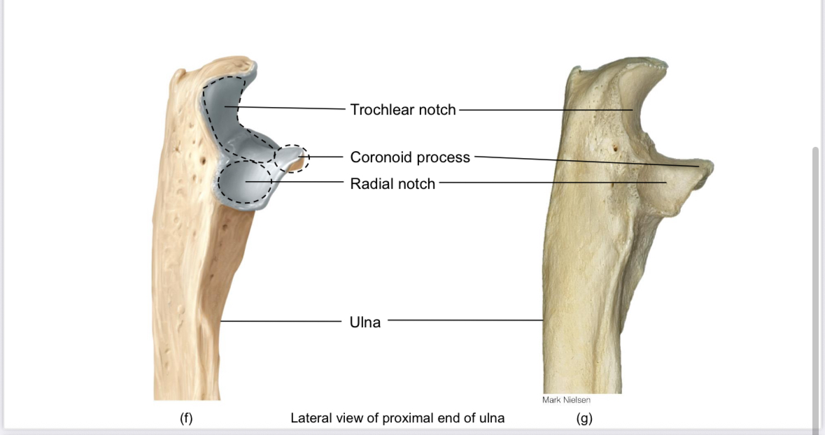 <p>Ulna: coronoid process</p>