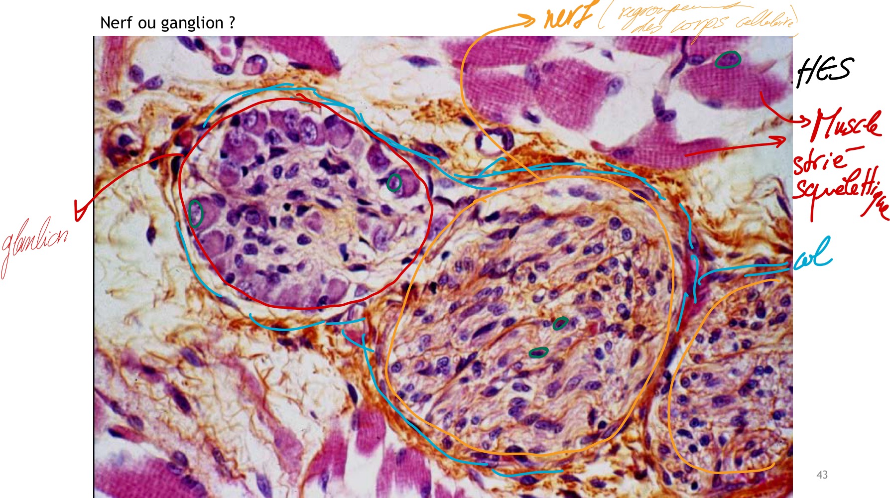 <p>HES </p><p>Ganglion à gauche et nerf à droite </p><p>Muscle strié squelettique </p>