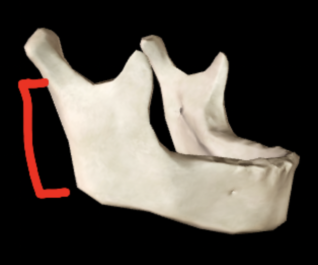 <p>What part of the mandible is this?</p>